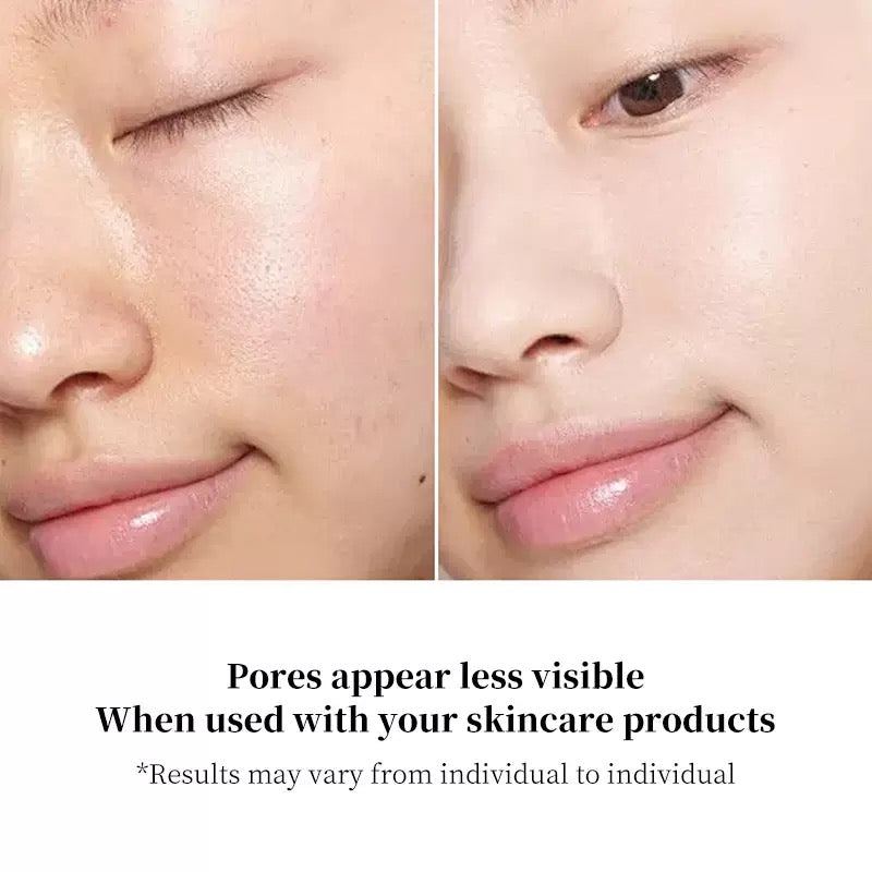 EMS essence infusion eye beauty device
