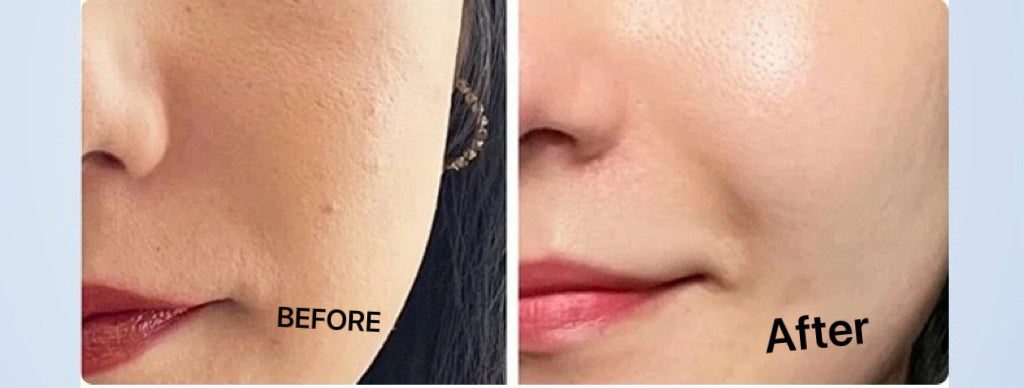 Repair skin barrier enhance deep hydration repair pores water-light gun