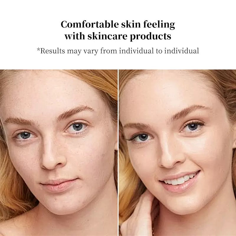EMS essence infusion eye beauty device
